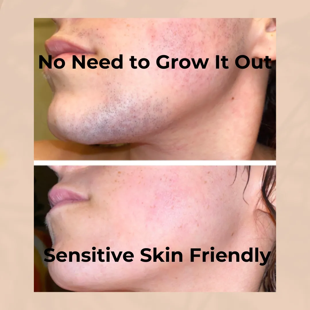 Mother's Day HOT SALE 50% OFFHair Removal Kit